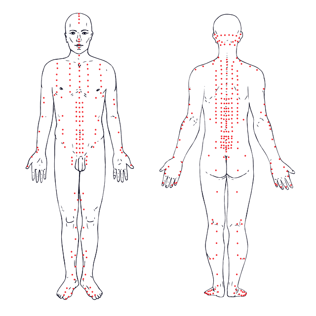 Pop-art style diagram of a man’s body, used for acupuncture.
